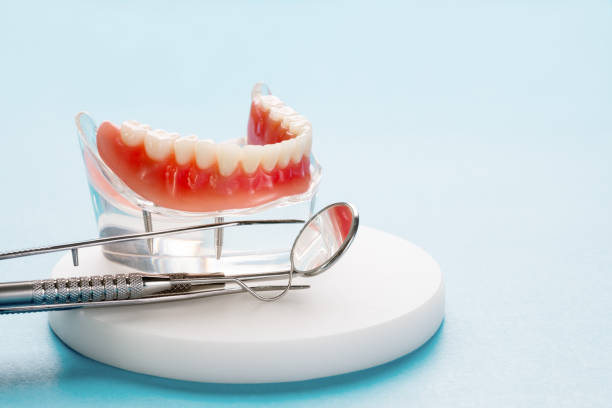 Full Mouth Reconstruction in Palm City, FL